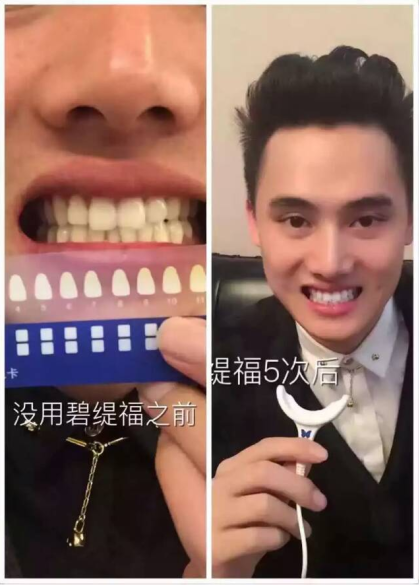 蓝光美白牙齿什么原理_鼠标蓝光什么灵敏度(3)
